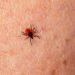 Tennessee Department of Health Urges Tennesseans to Take Precautions Against Ticks